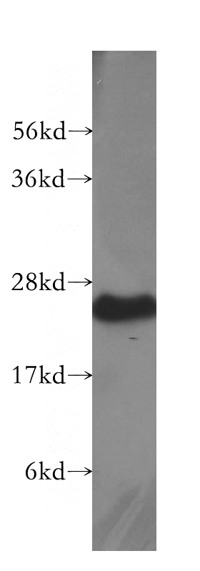 K-562 cells were subjected to SDS PAGE followed by western blot with Catalog No:113952(PLDN antibody) at dilution of 1:500