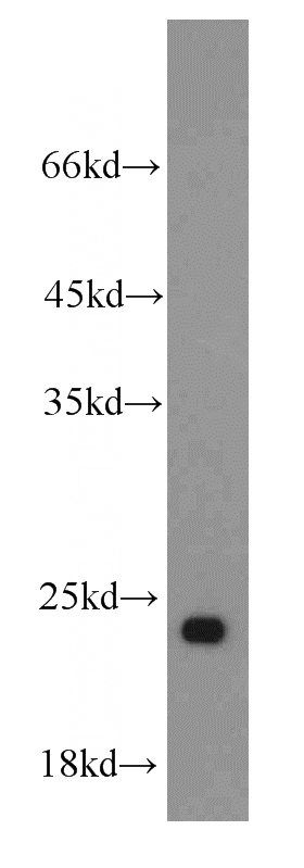 HepG2 cells were subjected to SDS PAGE followed by western blot with Catalog No:114876(RPL21 antibody) at dilution of 1:300