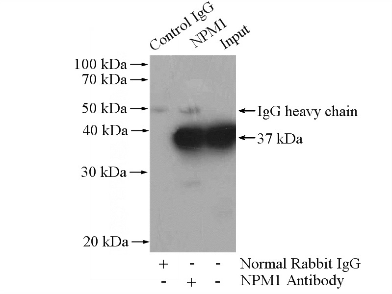 IP Result of anti-B23 (IP:Catalog No:117084, 4ug; Detection:Catalog No:117084 1:2000) with Jurkat cells lysate 3200ug.