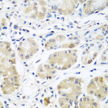 Immunohistochemistry - EIF3A Polyclonal Antibody 