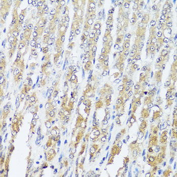 Immunohistochemistry - MCCC2 Polyclonal Antibody 