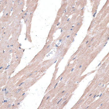 Immunohistochemistry - PPT2 Polyclonal Antibody 