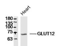 Fig1: Sample:; Heart (Rat) Lysate at 40 ug; Primary: Anti- GLUT12 at 1/300 dilution; Secondary: IRDye800CW Goat Anti-Rabbit IgG at 1/20000 dilution; Predicted band size: 68kD; Observed band size: 68kD