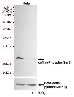 Western blot detection of cofilin(Phospho-Ser3) in Hela cells untreated or treated with H2O2 using cofilin(Phospho-Ser3) Rabbit pAb (dilution 1:500, upper) or u03b2-Actin Mouse mAb (200068-8F10, lower).Predicted band size:19kDa.Observed band size:19kDa.