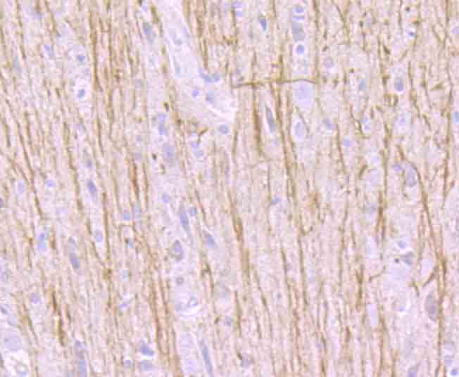 Fig5: Immunohistochemical analysis of paraffin-embedded rat brain tissue using anti-TrkA antibody. Counter stained with hematoxylin.
