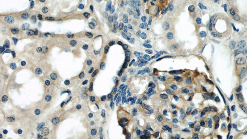 Immunohistochemical of paraffin-embedded human kidney using Catalog No:113988(PODXL antibody) at dilution of 1:50 (under 40x lens)