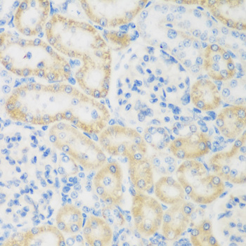 Immunohistochemistry - NAT8B Polyclonal Antibody 