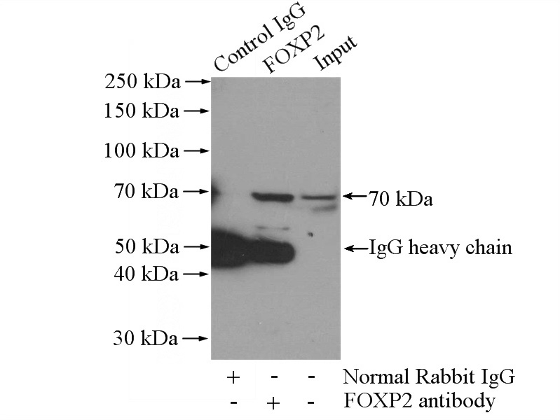 IP Result of anti-FOXP2 (IP:Catalog No:110709, 4ug; Detection:Catalog No:110709 1:500) with mouse spleen tissue lysate 4000ug.