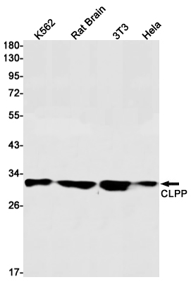 Western blot detection of CLPP in K562,Rat Brain,3T3,Hela cell lysates using CLPP Rabbit mAb(1:1000 diluted).Predicted band size:30kDa.Observed band size:30kDa.