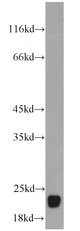 mouse brain tissue were subjected to SDS PAGE followed by western blot with Catalog No:114861(RTN1 antibody) at dilution of 1:800