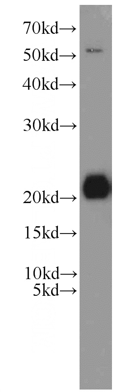 K-562 cells were subjected to SDS PAGE followed by western blot with Catalog No:111955(ITPA antibody) at dilution of 1:1000