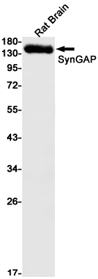 Western blot detection of SynGAP in Rat Brain cell using SynGAP Rabbit mAb(1:1000 diluted).Predicted band size:148kDa.Observed band size:148kDa.
