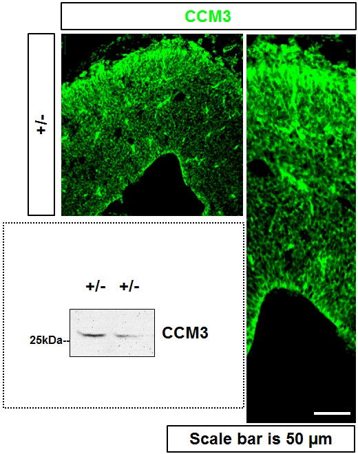 WB and IF result of CCM3 antibody (courtesy of Dr. Shah, University of Muenster). IF note: E15 mouse brain cortex was PFA fixed, the sections were antigen retrieved with Na-citrate buffer (pH 6) and blocked with NGS and Triton X100. 1:150 dilution of CCM3 antibody was used with overnight incubation of sections at 4 degrees. Secondary anti-Rabbit conjugated to AF488 was used to detect the staining.