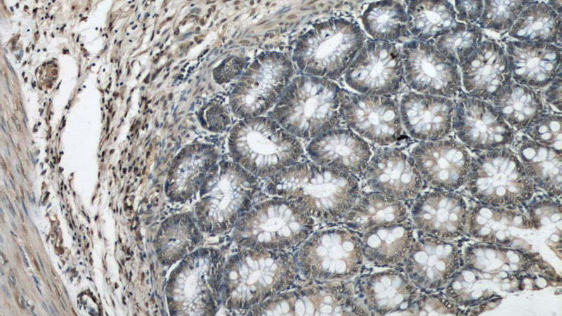 Immunohistochemical of paraffin-embedded human colon using Catalog No:110883(GATA5 antibody) at dilution of 1:50 (under 10x lens)