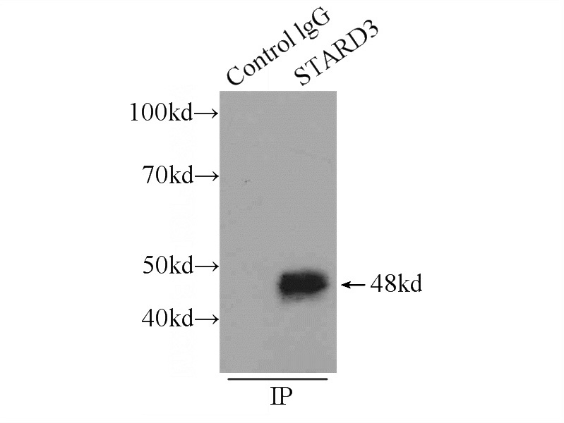 IP Result of anti-MLN64,STARD3 (IP:Catalog No:112685, 3ug; Detection:Catalog No:112685 1:500) with MCF-7 cells lysate 1200ug.