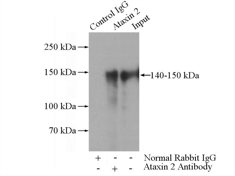 IP Result of anti-Ataxin 2 (IP:Catalog No:108280, 4ug; Detection:Catalog No:108280 1:1000) with HEK-293 cells lysate 1200ug.