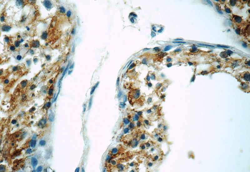 Immunohistochemistry of paraffin-embedded human testis tissue slide using Catalog No:111667(RABL4 Antibody) at dilution of 1:50 (under 40x lens)