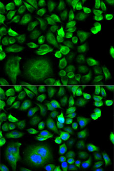 Immunofluorescence - MSMB Polyclonal Antibody 