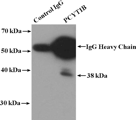 IP Result of anti-PCYT1B (IP:Catalog No:113759, 4ug; Detection:Catalog No:113759 1:500) with human placenta tissue lysate 4000ug.