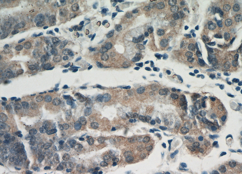 Immunohistochemical of paraffin-embedded human stomach using Catalog No:107980(ALG13 antibody) at dilution of 1:100 (under 40x lens)
