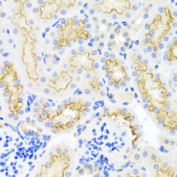 Immunohistochemistry - SRPX Polyclonal Antibody 