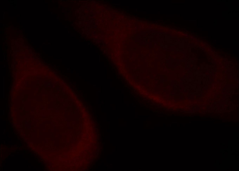 Immunofluorescent analysis of Hela cells, using HPRT1 antibody Catalog No:111450 at 1:25 dilution and Rhodamine-labeled goat anti-rabbit IgG (red).