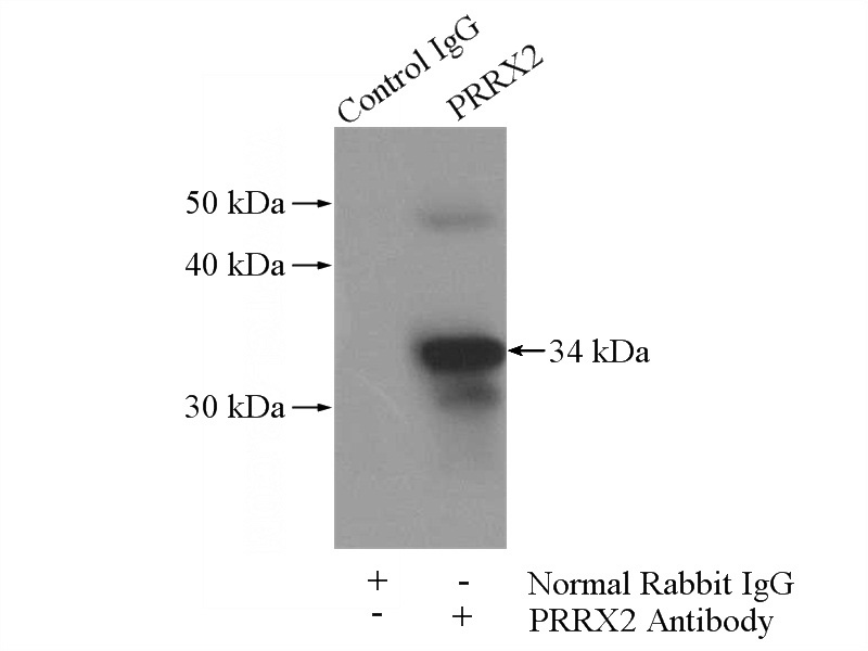 IP Result of anti-PRRX2 (IP:Catalog No:114279, 4ug; Detection:Catalog No:114279 1:500) with mouse brain tissue lysate 3440ug.