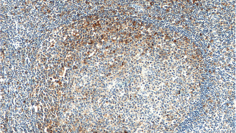 Immunohistochemistry of paraffin-embedded human tonsillitis tissue slide using Catalog No:108415(BAK Antibody) at dilution of 1:200 (under 10x lens).