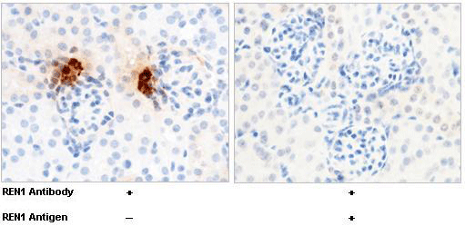 REN1 / Renin-1 Antibody, Rabbit MAb, Immunohistochemistry