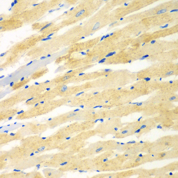 Immunohistochemistry - PDE4DIP Polyclonal Antibody 