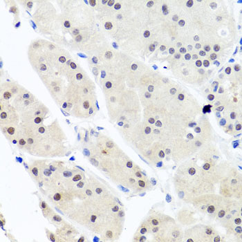 Immunohistochemistry - HNRNPCL1 Polyclonal Antibody 