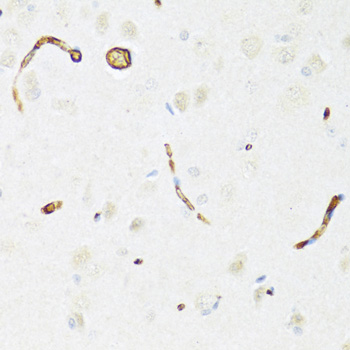Immunohistochemistry - P Glycoprotein Polyclonal Antibody 