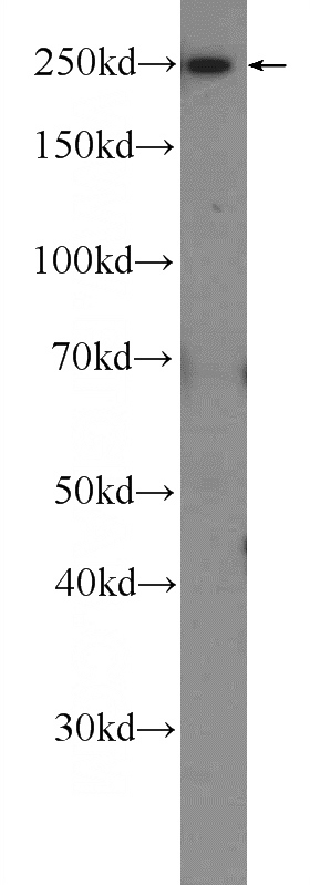 HeLa cells were subjected to SDS PAGE followed by western blot with Catalog No:108294(ATG2B Antibody) at dilution of 1:600