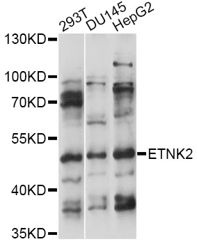 Western blot - ETNK2 Polyclonal Antibody 