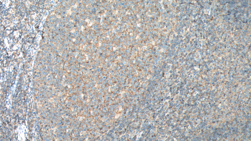 Immunohistochemistry of paraffin-embedded human tonsillitis tissue slide using (CD200 Antibody) at dilution of 1:200 (under 10x lens). heat mediated antigen retrieved with Tris-EDTA buffer(pH9).