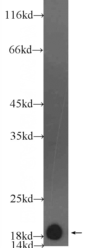 rat heart tissue were subjected to SDS PAGE followed by western blot with Catalog No:112942(MYL2 Antibody) at dilution of 1:5000