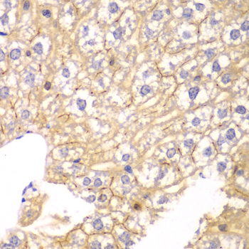 Immunohistochemistry - PPP2R2A Polyclonal Antibody 