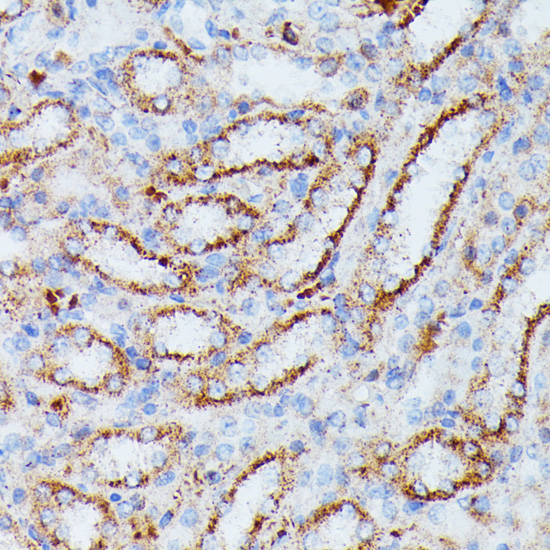 Immunohistochemistry - IDH3A Polyclonal Antibody 