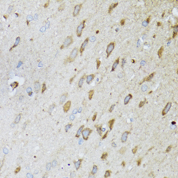 Immunohistochemistry - MT-ND5 Polyclonal Antibody 