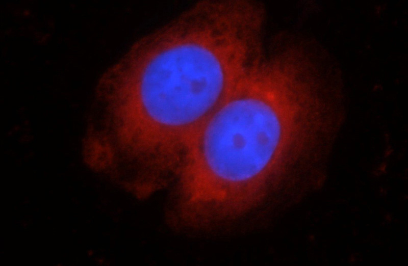 Immunofluorescent analysis of HepG2 cells using Catalog No:111460(HRAS-Specific Antibody) at dilution of 1:25 and Rhodamine-Goat anti-Rabbit IgG