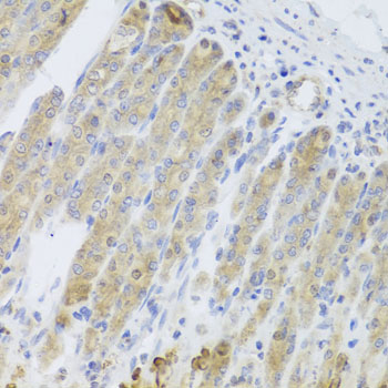 Immunohistochemistry - RARS2 Polyclonal Antibody 