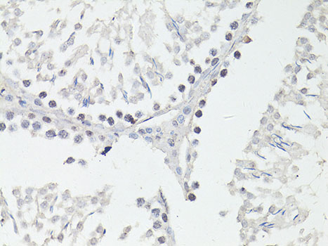 Immunohistochemistry - FTO Polyclonal Antibody 