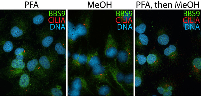 IF result (cytoplasm stain) of anti-BBS9 (Catalog No:108377; 1:50) with hTERT-RPE1 cell by Dr. Moshe Kim.