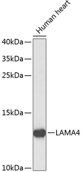 Western blot - LAMA4 Polyclonal Antibody 