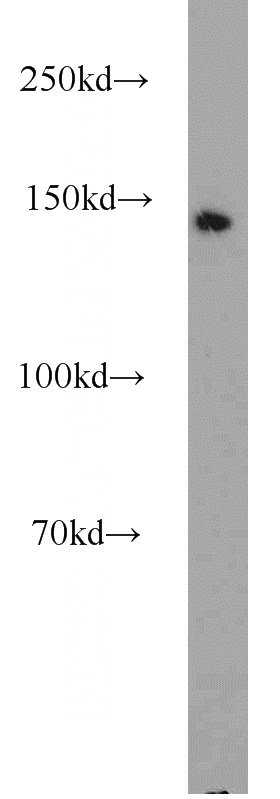 mouse testis tissue were subjected to SDS PAGE followed by western blot with Catalog No:109367(COG1 antibody) at dilution of 1:1000
