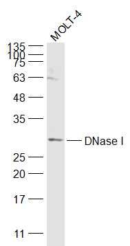 Fig1: Sample:; MOLT-4(Human) Cell Lysate at 30 ug; Primary: Anti-DNase I at 1/1000 dilution; Secondary: IRDye800CW Goat Anti-Rabbit IgG at 1/20000 dilution; Predicted band size: 29 kD; Observed band size: 29 kD