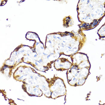 Immunohistochemistry - HSD17B1 Polyclonal Antibody 