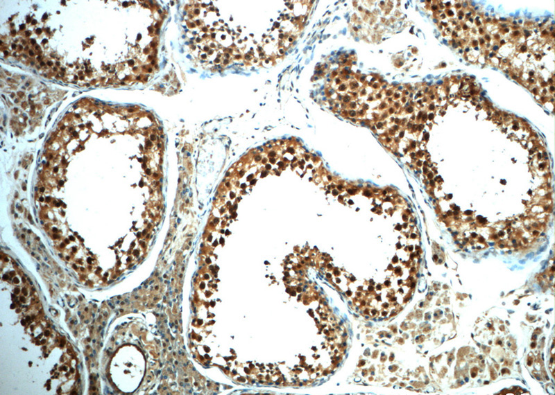 Immunohistochemistry of paraffin-embedded human testis slide using Catalog No:108867(CSNK2B Antibody) at dilution of 1:50