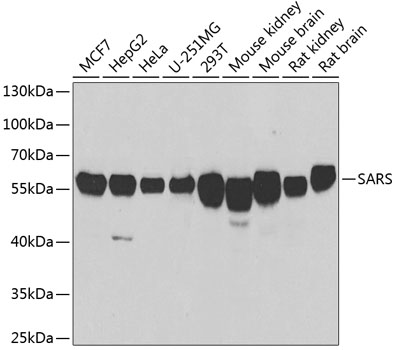 Western blot - SARS Polyclonal Antibody 