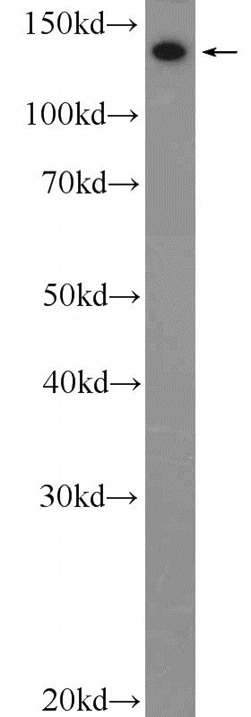 mouse skin tissue were subjected to SDS PAGE followed by western blot with Catalog No:109377(COL3A1 Antibody) at dilution of 1:1000